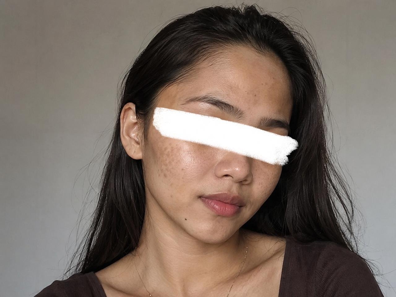 Tone kulit kurang merata